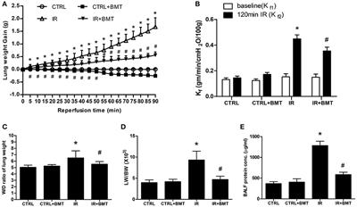 Inhibition of NKCC1 Modulates Alveolar Fluid Clearance and Inflammation in Ischemia-Reperfusion Lung Injury via TRAF6-Mediated Pathways